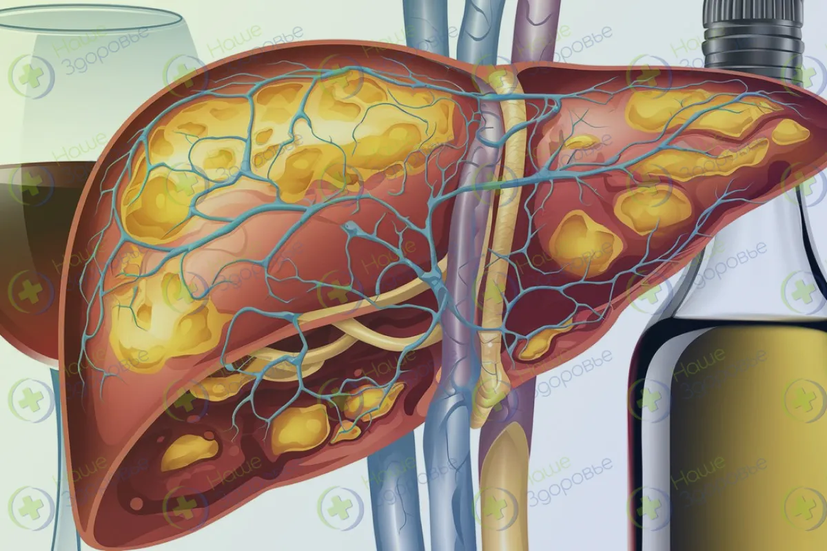 Печень и бутылки алкоголя